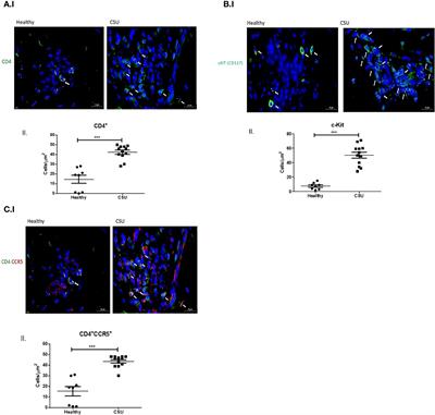CD4+CCR5+ T cells and CCL3+ mast cells are increased in the skin of patients with chronic spontaneous urticaria